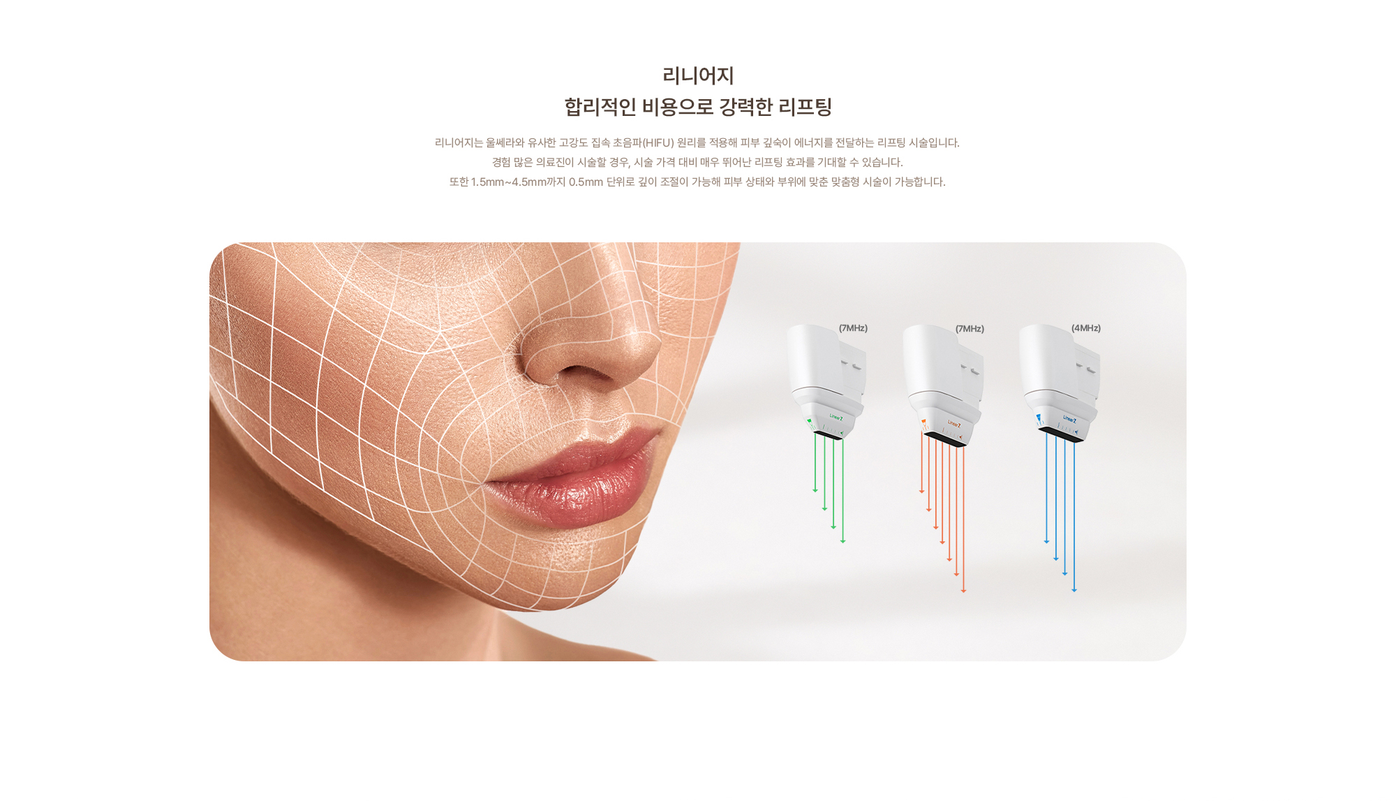 [리니어지, 합리적인 비용으로 강력한 리프팅] 리니어지는 울쎄라와 유사한 고강도 집속 초음파(HIFU) 원리를 적용해 피부 깊숙이 에너지를 전달하는 리프팅 시술입니다. 경험 많은 의료진이 시술할 경우, 시술 가격 대비 매우 뛰어난 리프팅 효과를 기대할 수 있습니다. 또한 1.5mm~4.5mm까지 0.5mm 단위로 깊이 조절이 가능해 피부 상태와 부위에 맞춘 맞춤형 시술이 가능합니다.